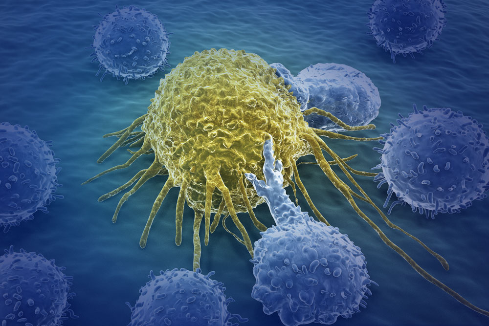 immuno-oncology